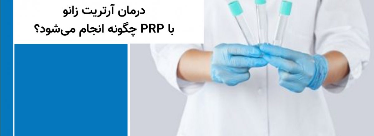 درمان آرتریت زانو با PRP چگونه انجام می‌شود؟