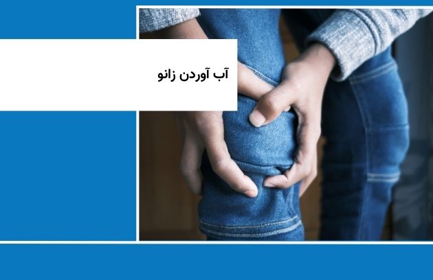 آب آوردن زانو