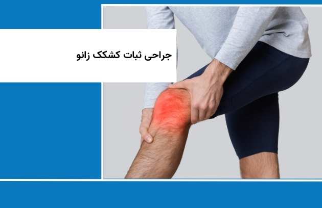 جراحی ثبات کشکک زانو